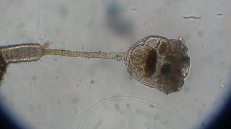 Entoprocta under microscope