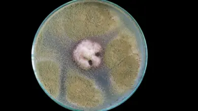 Macro of Chlorophytes On Petri Dish