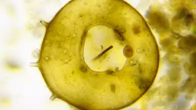 Microscope View of Amoeba What Eats An Amoeba