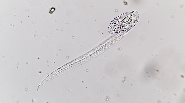 larvacea under microscope